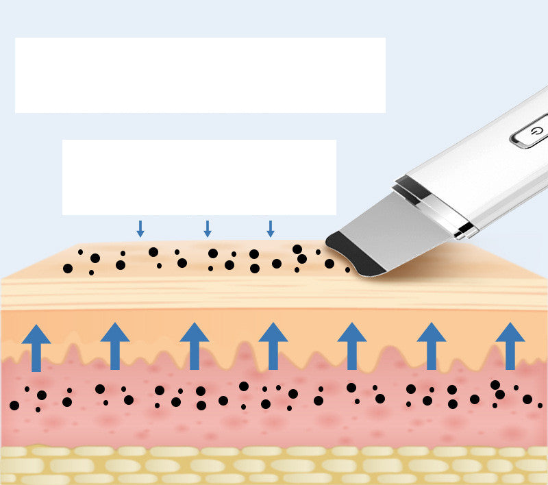 Pore Cleaning New Radiant Skin Instrument